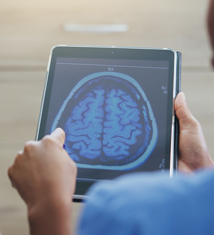 Photo of health worker reviewing brain scan on a tablet