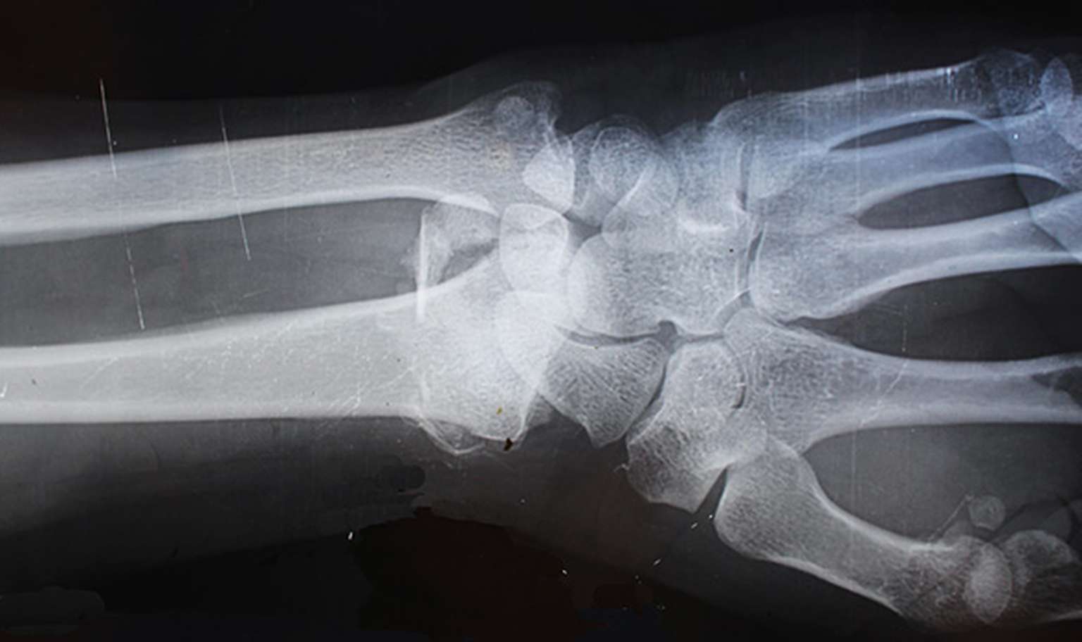 block header personal injury