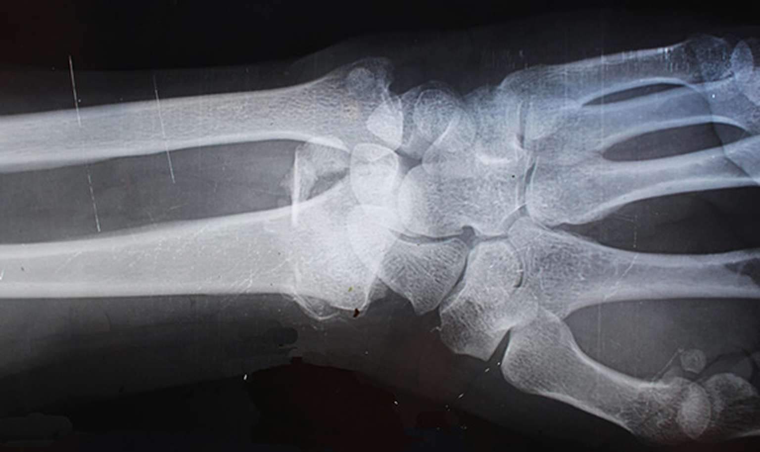 block header personal injury