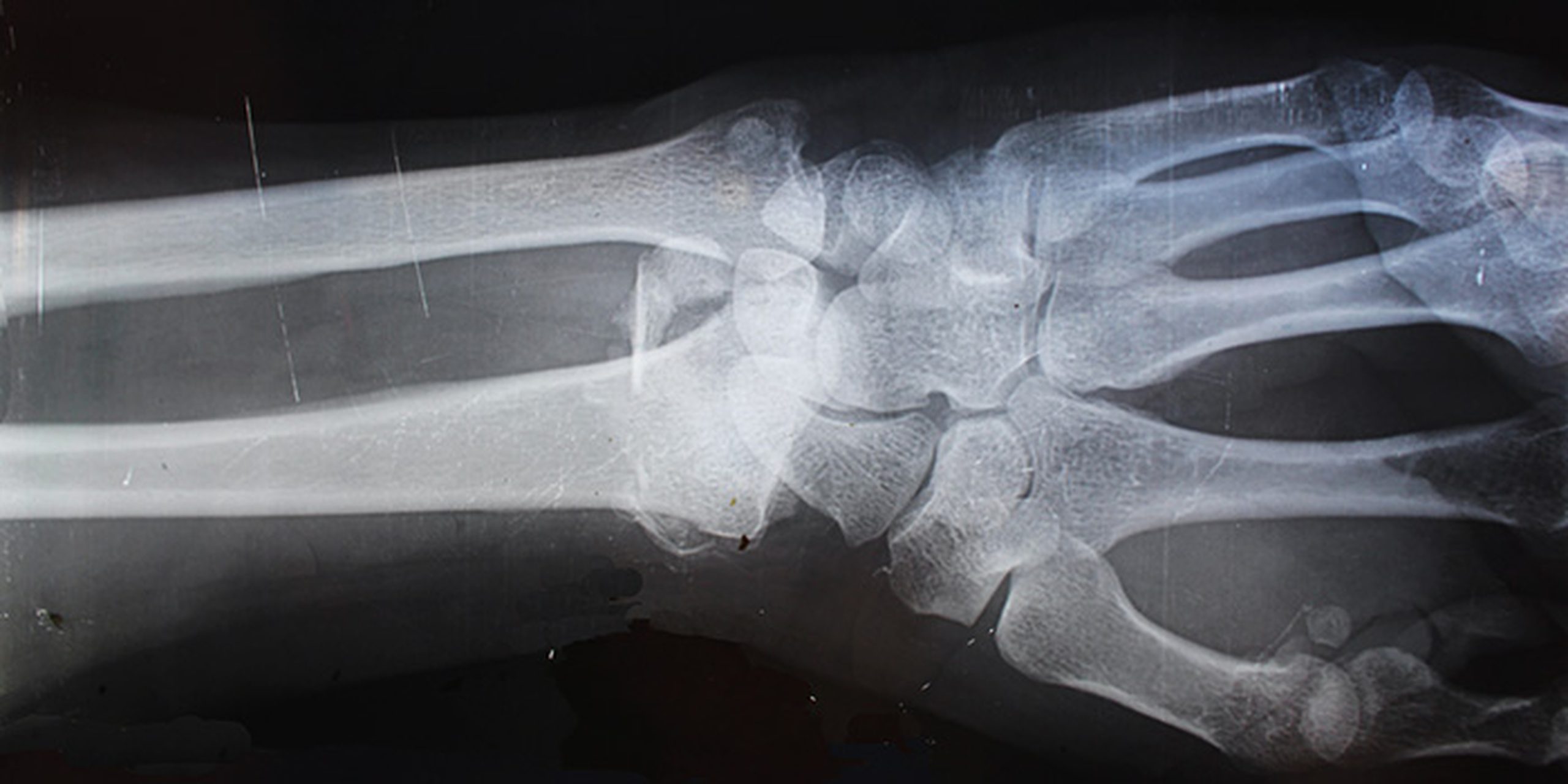 block header personal injury