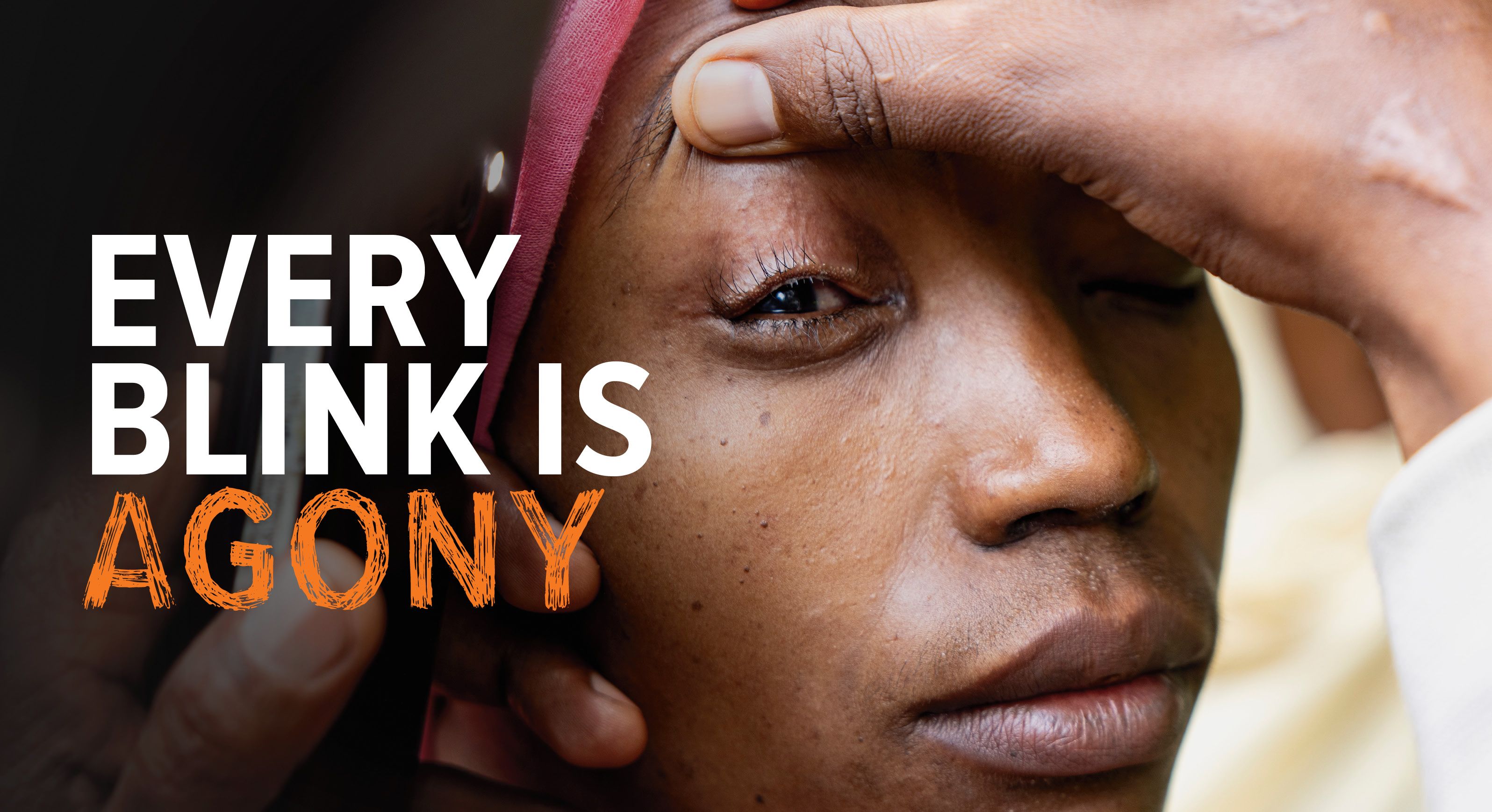 Close-up of a woman pulling back her eyelid beside the text “Every Blink Is Agony.”