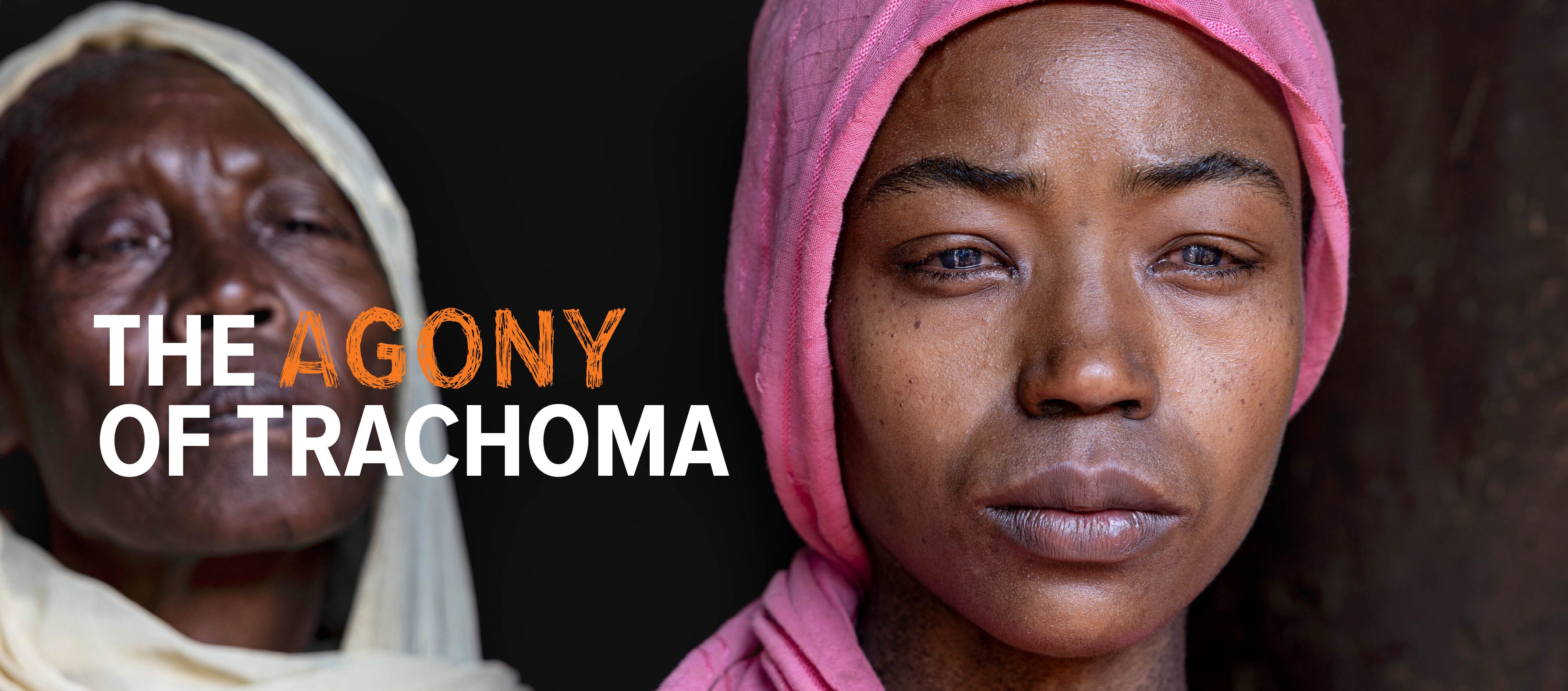 Close-up portraits of two people with trachoma beside the text “The Agony of Trachoma.”