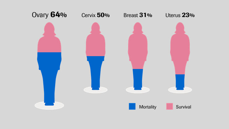 Roche | Ovarian cancer treatment advances over time – what’s next?