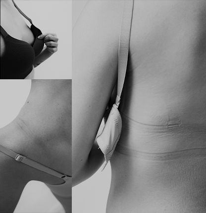 hp_cblock_brafreeplp