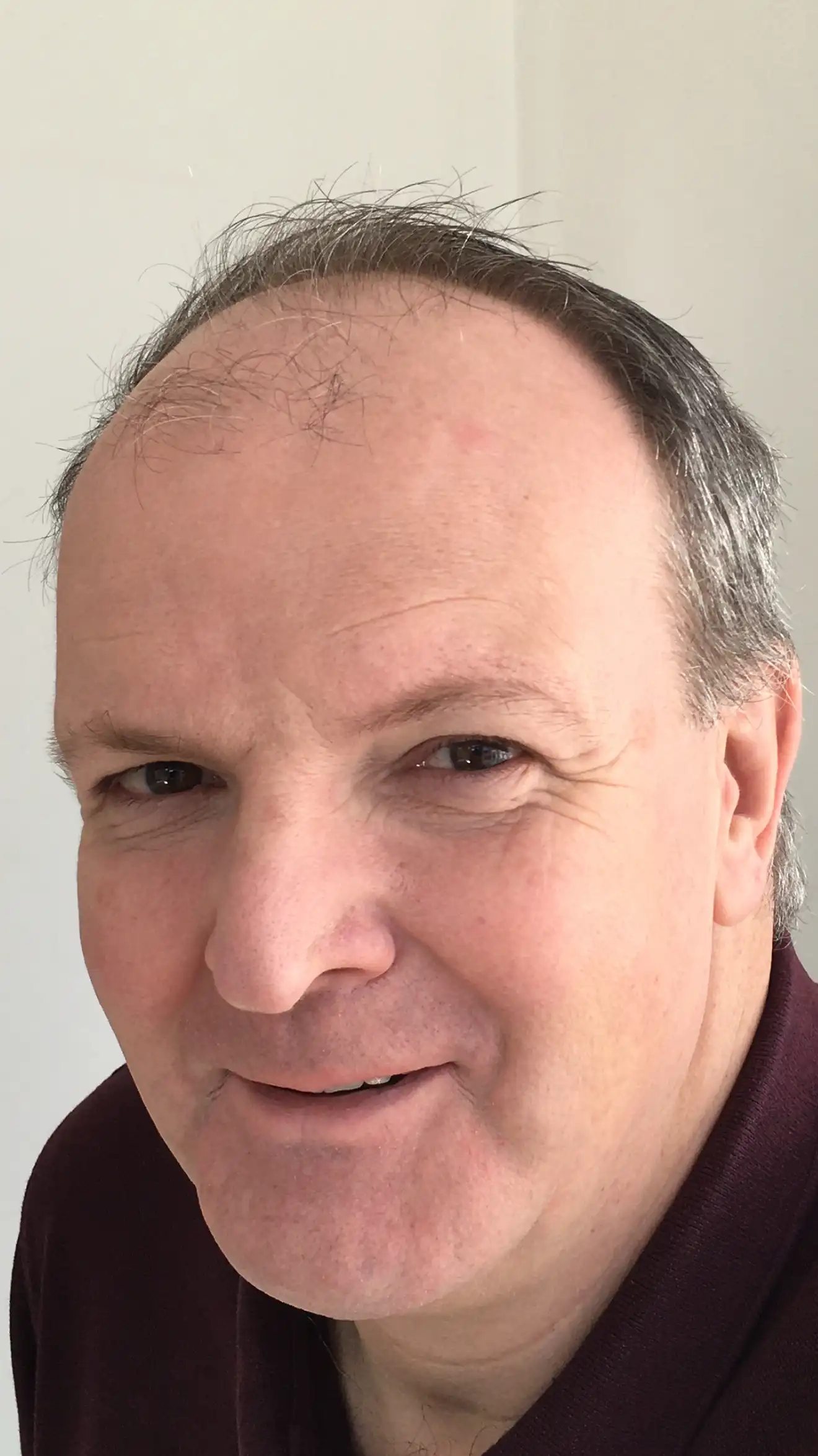 Photo of Fergus Dunlop