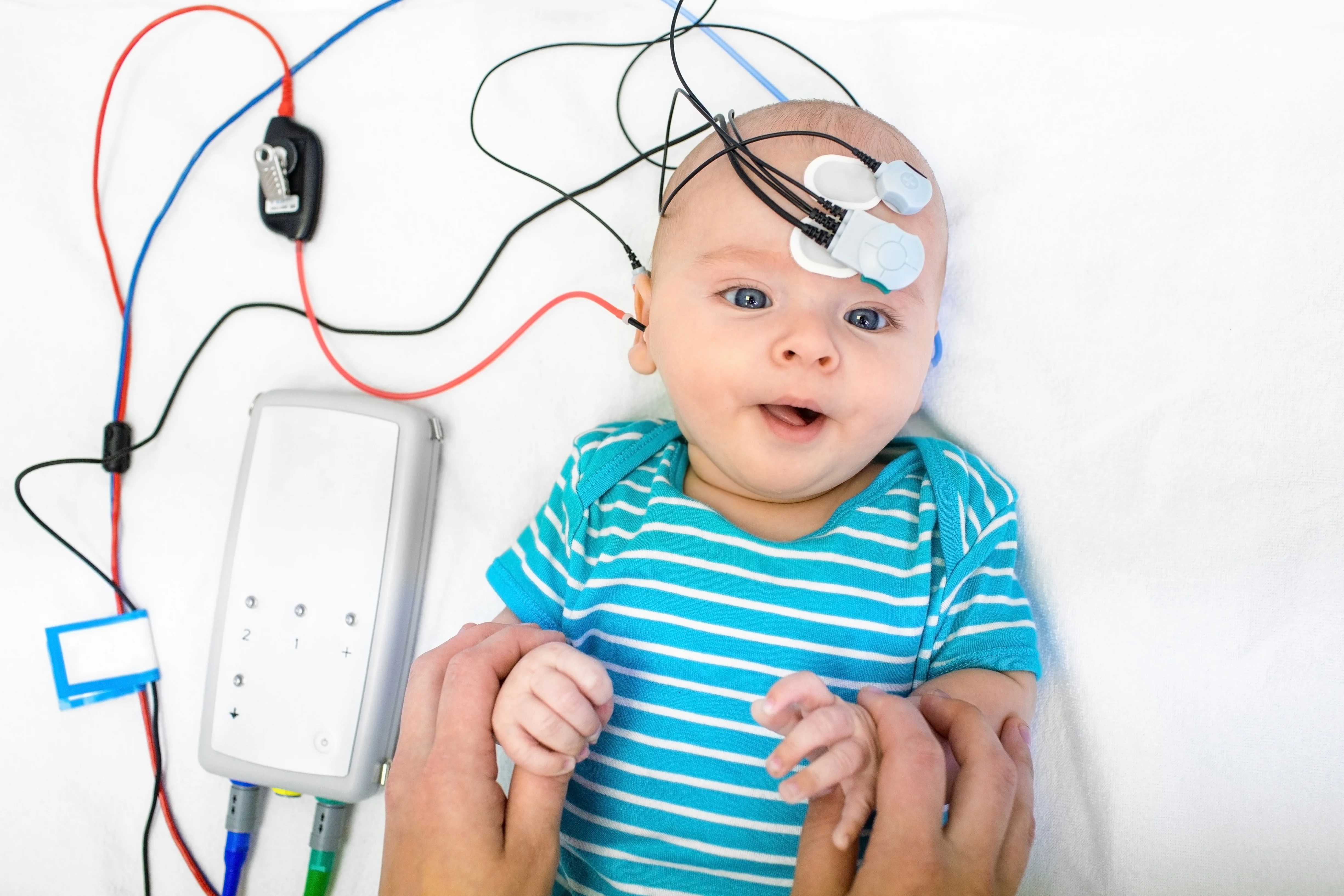 Auditory Brainstem Response Audiometry Image