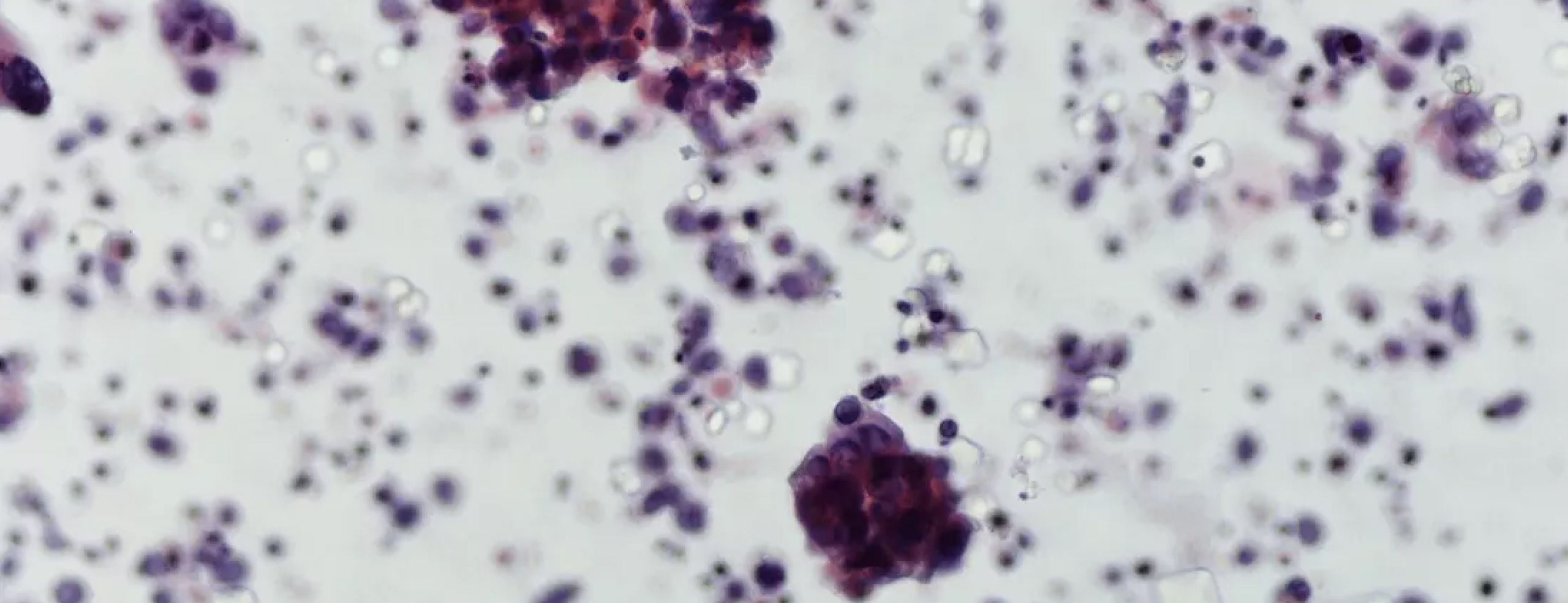 Healthcare - Enabling innovative accurate diagnostics for early bladder cancer detection