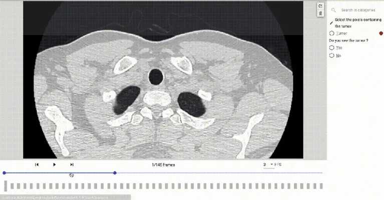Quality data is at the heart of AI medical diagnosis