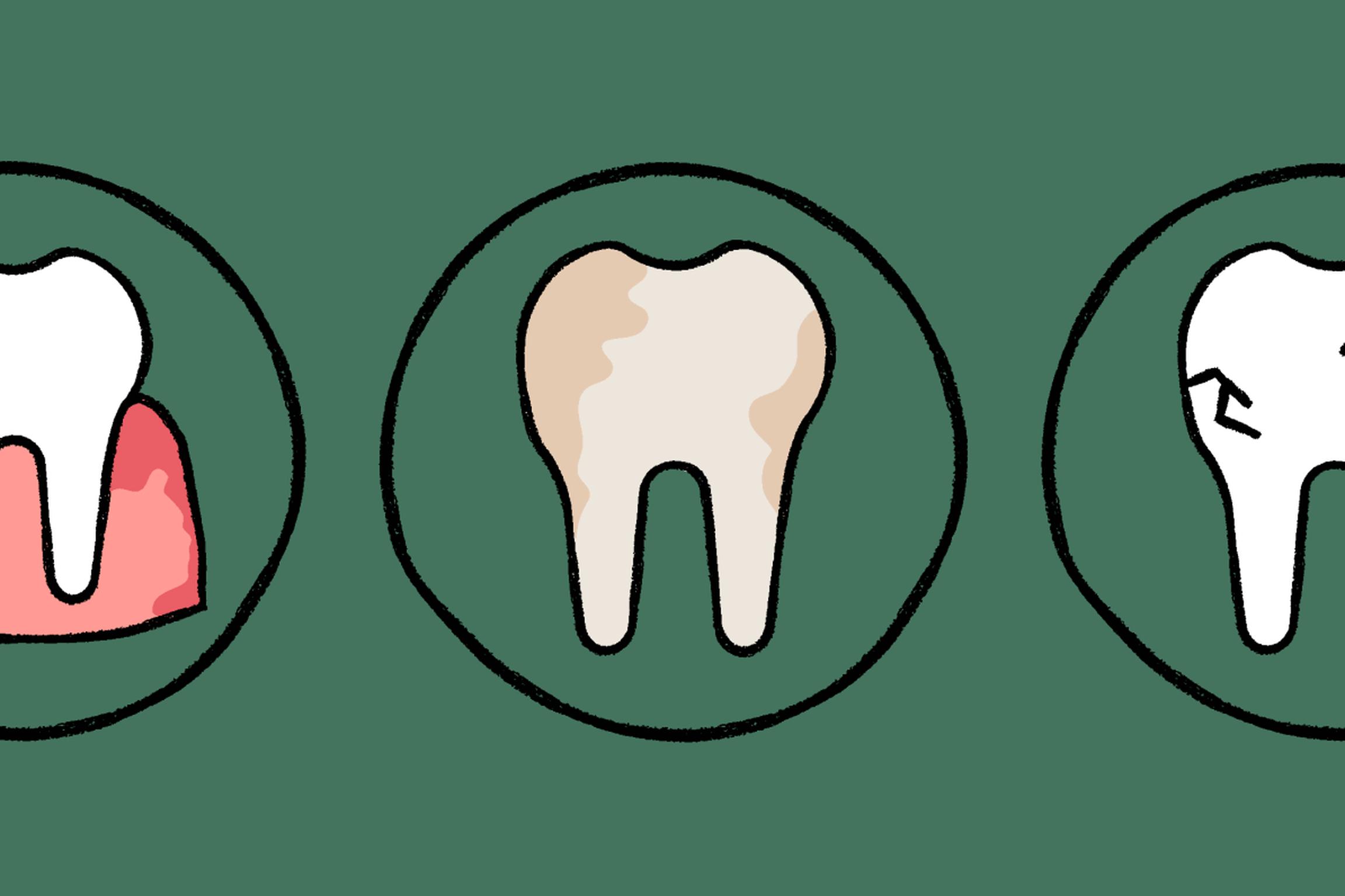 The image shows three circles, each depicting a tooth with a different condition:  Inflamed gums, Discoloration, and Cracks