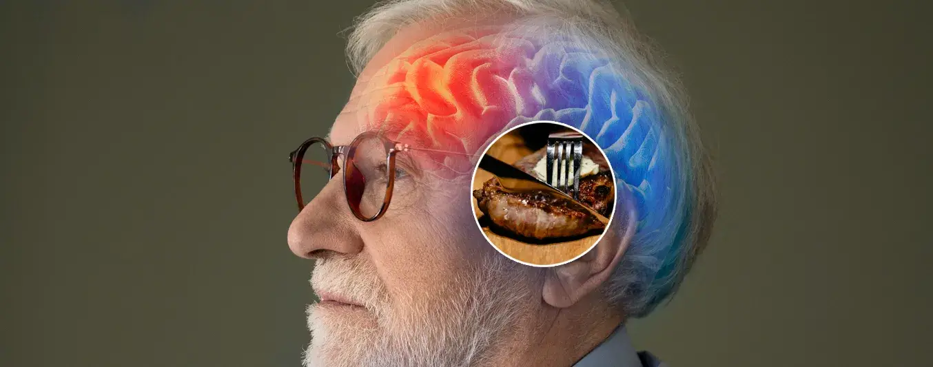 Estudio revela que una dieta alta en consumo de carne podría prevenir el Alzheimer