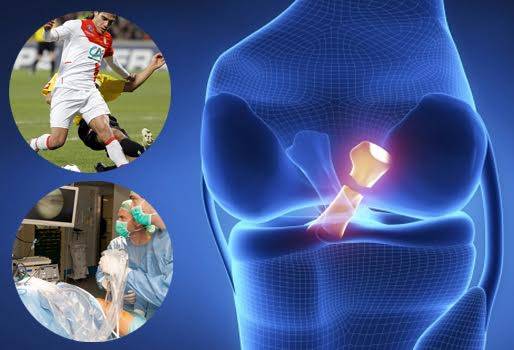 Rotura del ligamento cruzado tejidos de cerdo