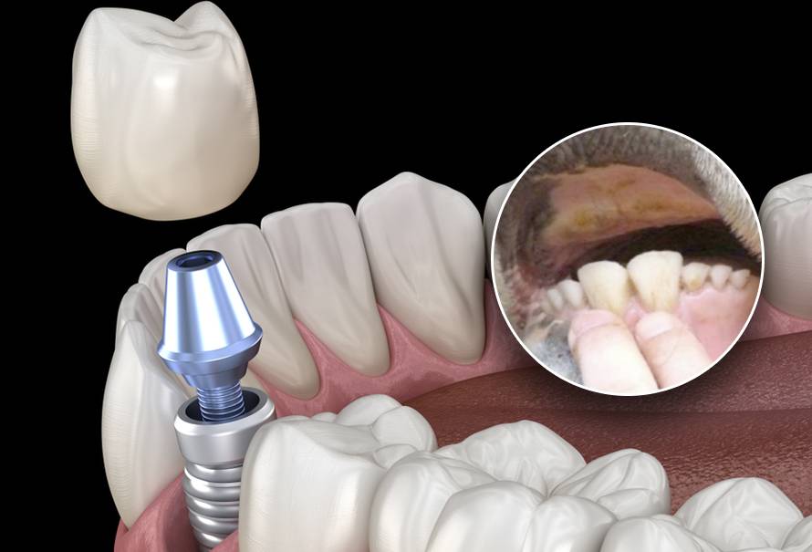 dientes-vaca-implantes-dientes-humanos