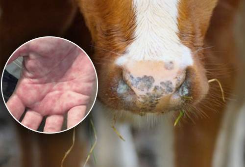 Colombia, primer caso confirmado de brucelosis humana en Colombia, Human brucellosis, Brucella melitensis, zoonoses, pregnancy, vacas, vacas Colombia, lechería, bovinos, ganadería bovina, Universidad CES Instituto Colombiano de Medicina Tropical, Infectio, noticias ganaderas, noticias ganaderas colombia, Contextoganadero.