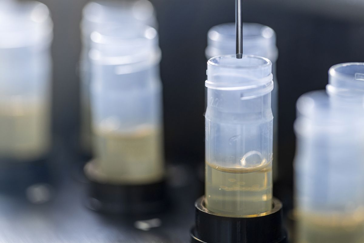 Pruebas de alergia en laboratorio