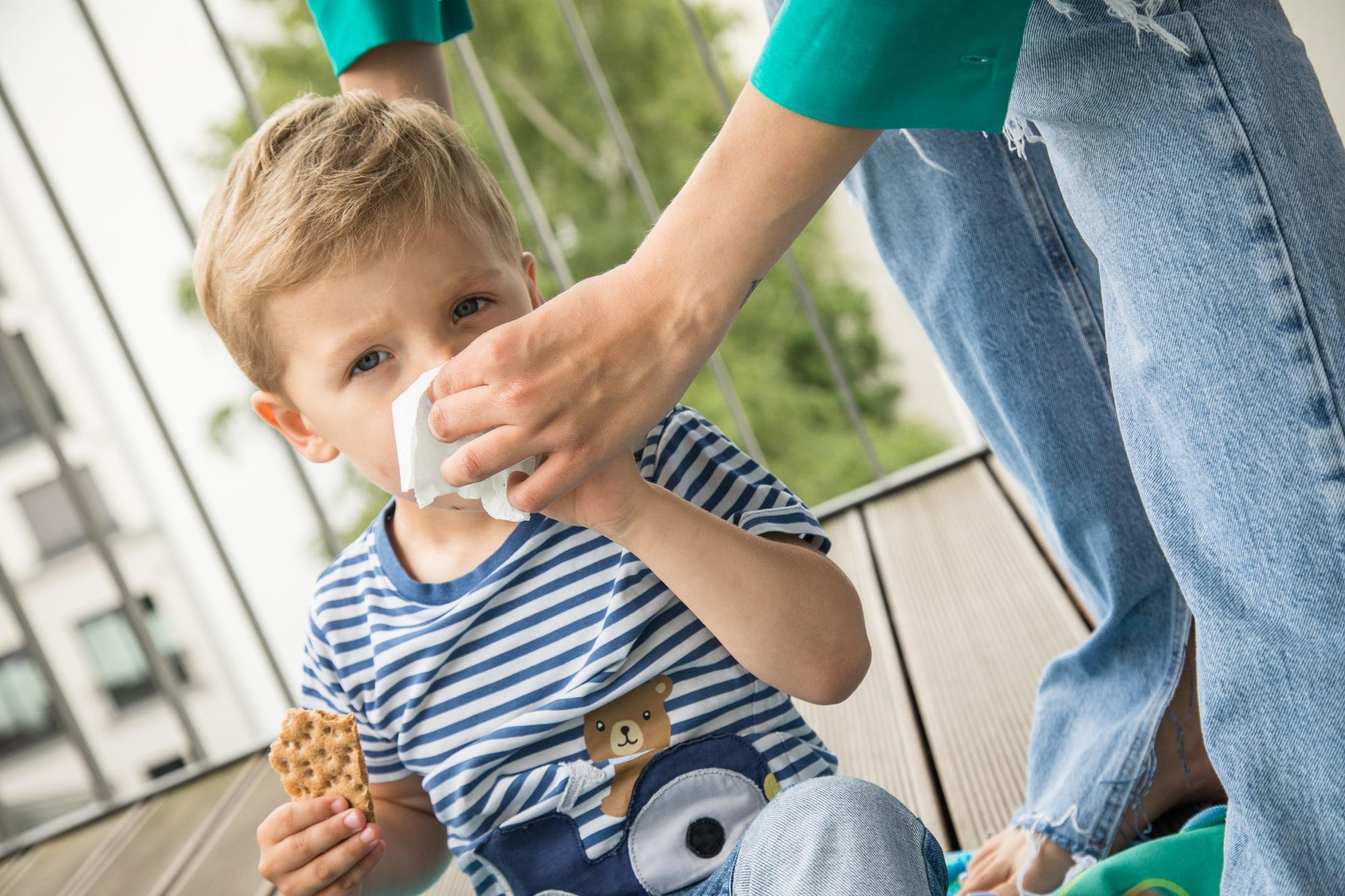 Wenn die Schniefnase läuft: Hausmittel können Symptome lindern.