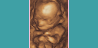 4D scan of a baby at 16 weeks gestation
