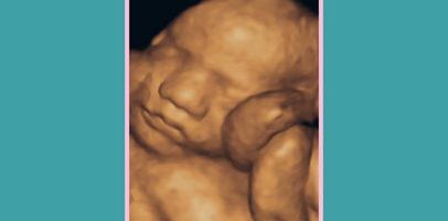 4D scan of a baby at 30 weeks gestation