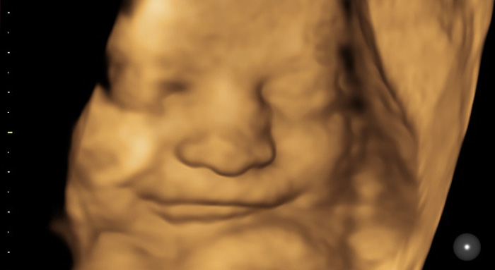 Ultrasound Direct Premium 4D Bonding Scan