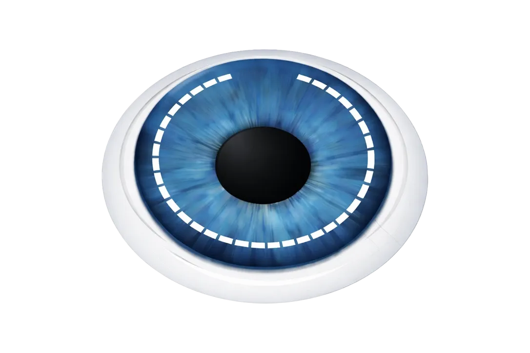 Skizze eines Auges zur Darstellung der Femto-LASIK-Methode beim Augenlasern.