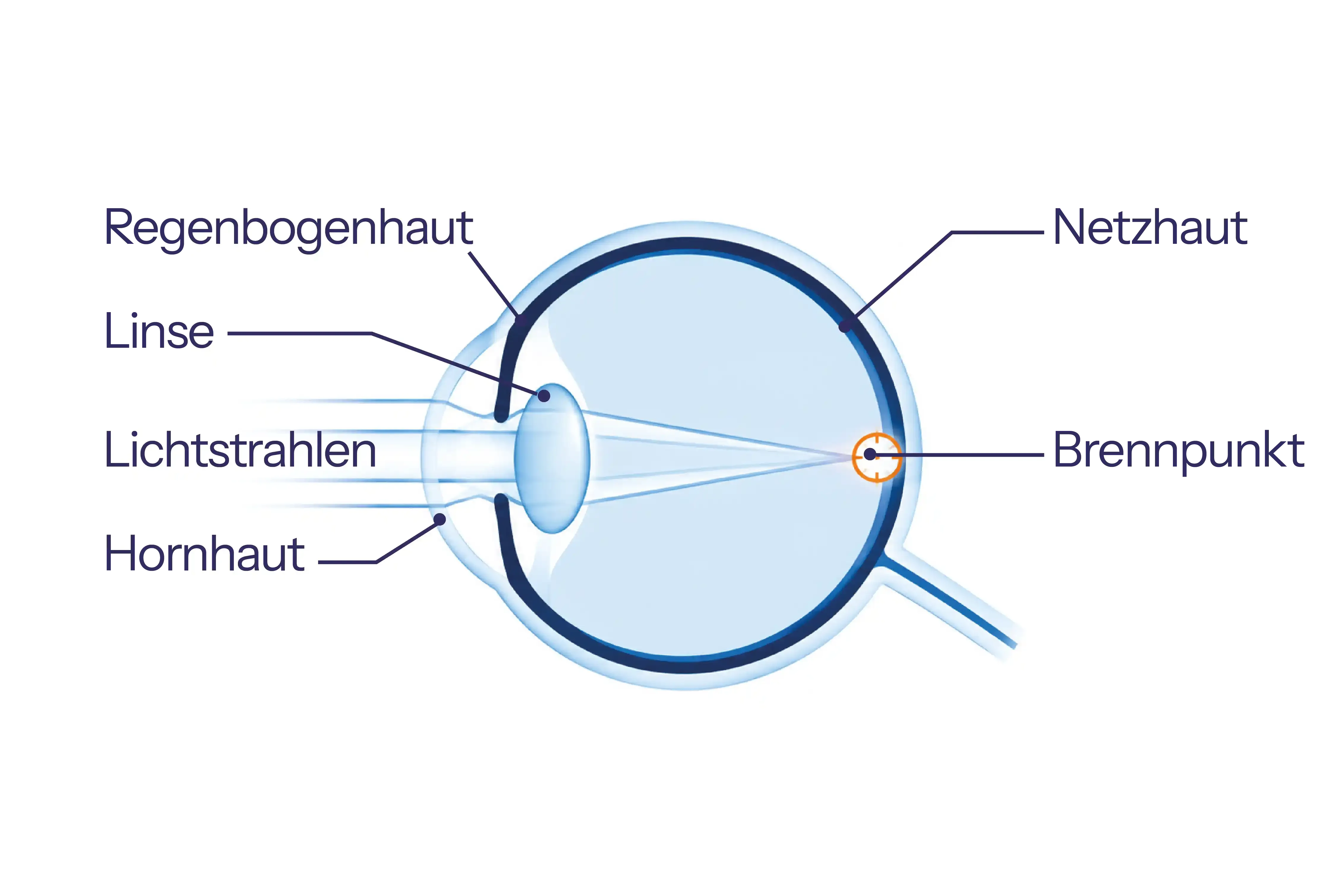 Illustration nach Laserbehandlung: Lichtstrahlen treffen exakt auf einen Punkt auf der Netzhaut, Sehen scharf