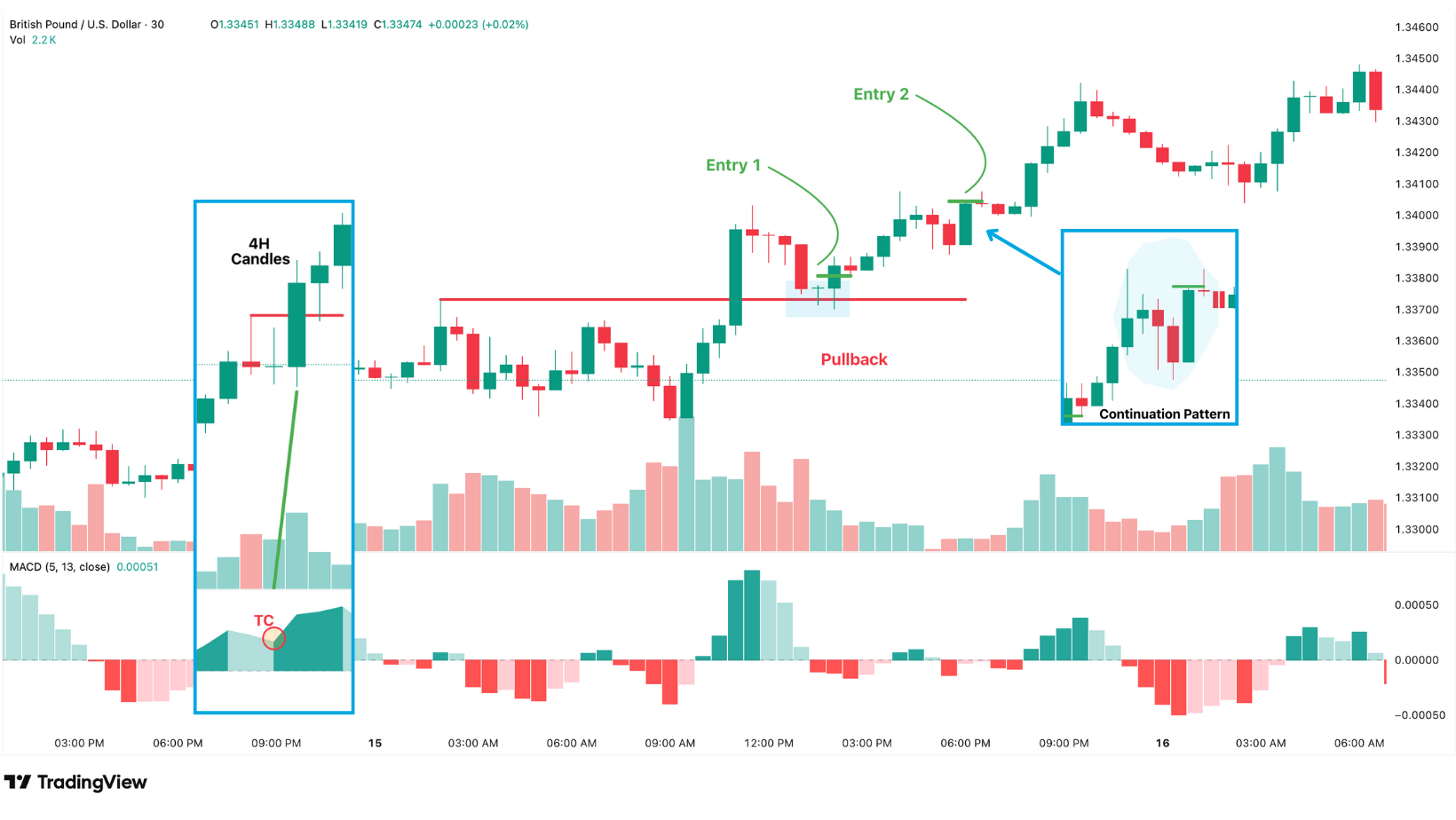 What is MACD (Moving Average Convergence Divergence)?