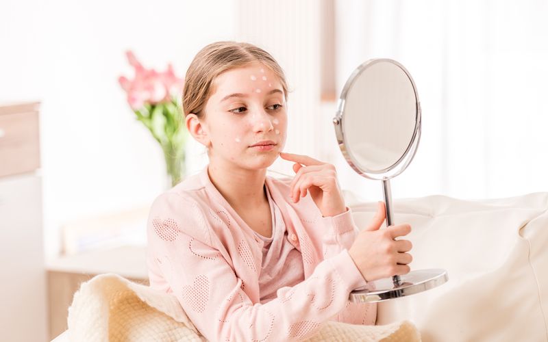 Windpocken - alle wichtigen Informationen zu den Varizellen