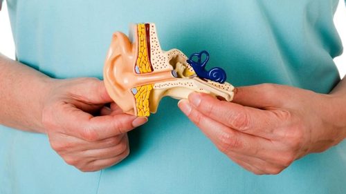 Neuropathia vestibularis