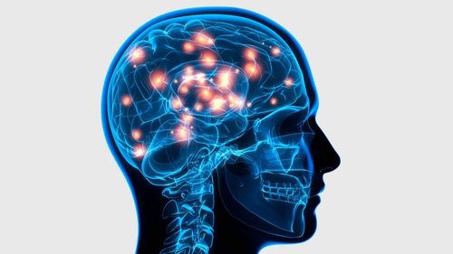 Zentralnervöse-Ursachen