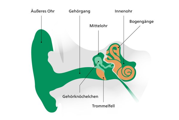 Infografik des Innenohrs zur Entstehung von gutartigem Lagerungsschwindel.