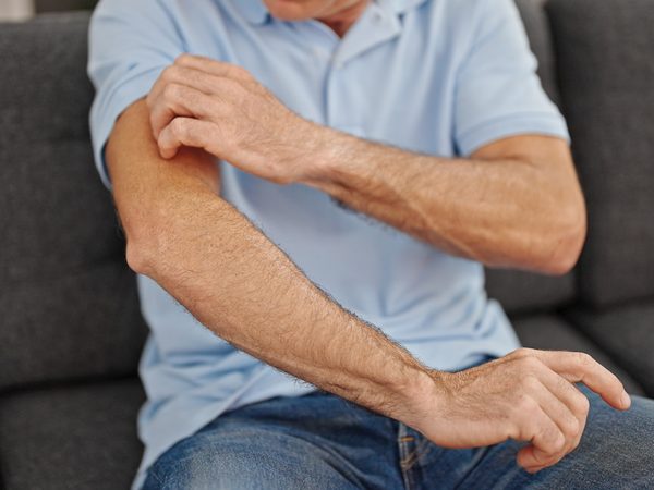 Mann kratzt sich an seinem Oberarm