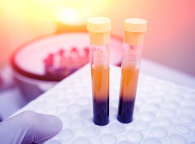 two vacutainers held with a gloved hand containing separated blood
