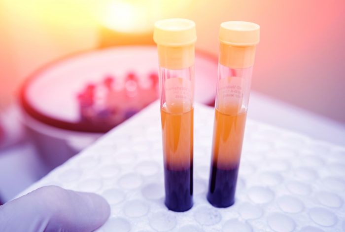 Single-cell multi-omics reveals elevated plasticity and stem-cell-like blasts relevant to the poor prognosis of *KMT2A*-rearranged leukemia