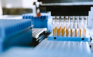 A rack of pipettes with library preparation