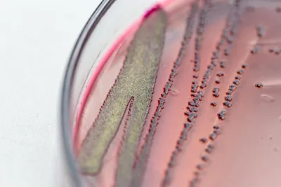 petri dish containing AMR bacteria