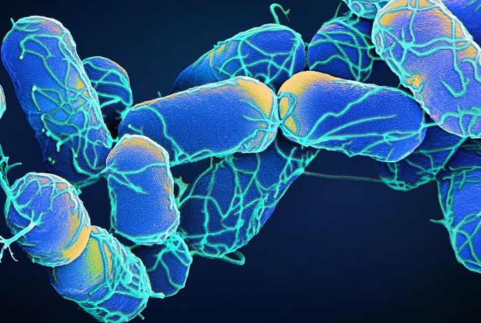 Accurately characterise bacterial genomes with nanopore-only data: a benchmarking study