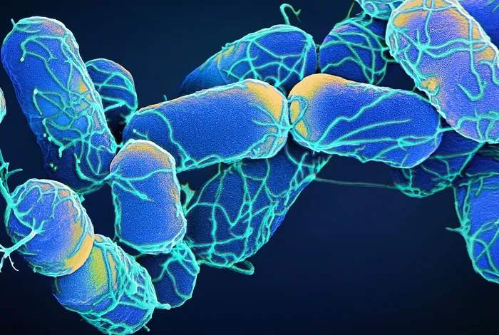 Accurately characterise bacterial genomes with nanopore-only data: a benchmarking study