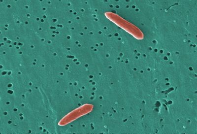 The Glycolytic Versatility of Bacteroides uniformis CECT 7771 and Its Genome Response to Oligo and Polysaccharides