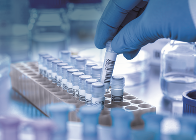 Gloved hand handling a labeled vial over a rack of test tubes in a laboratory setting, with blurred bottles in the background.