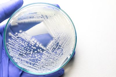 Yeast colonies on agar
