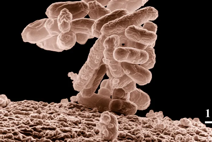 Real-time analysis of nanopore-based metagenomic sequencing from infected orthopaedic devices