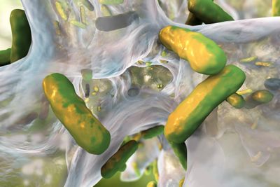 Biofilm of antibiotic resistant bacteria Pseudomonas aeruginosa