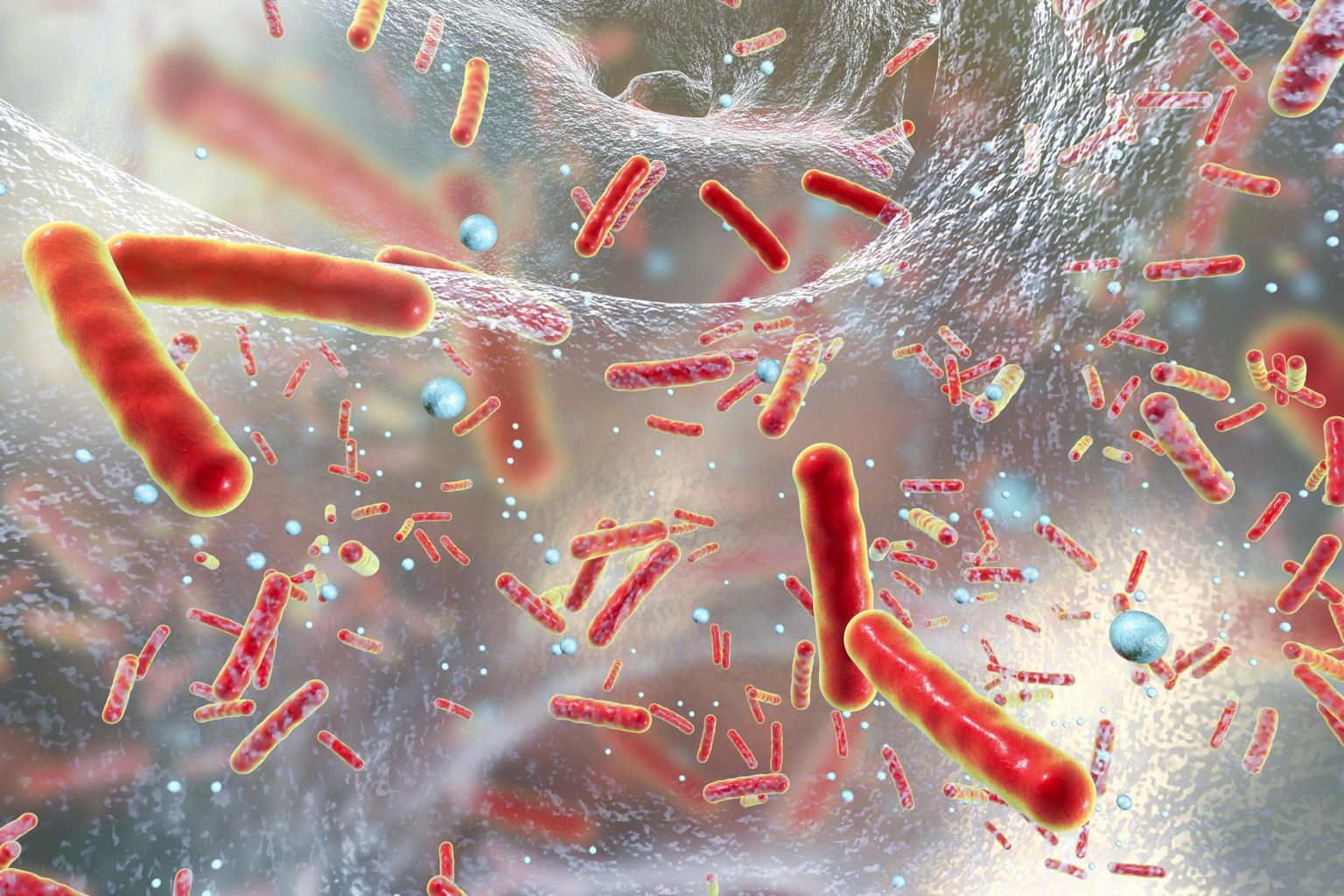 Routine metagenomics service for intensive care unit patients with respiratory infection
