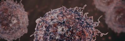 Concurrent L1 retrotransposition events promote reciprocal translocations in human tumorigenesis