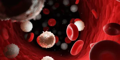 Blood cancer cells in leukaemia and red blood cells