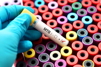 mycobacterium tuberculosis bacteria-positive test