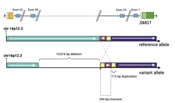 Graph illustrating a complex structural variant in the SMG1 gene