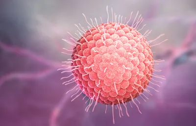 Varicella zoster virus
