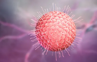 Varicella zoster virus