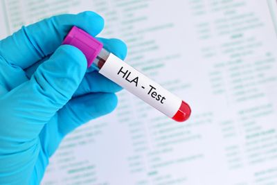 A simplified, scalable solution for simultaneous genotyping of human leukocyte antigen classical class I and human platelet antigen genes utilising Oxford Nanopore Technologies long-read sequencing