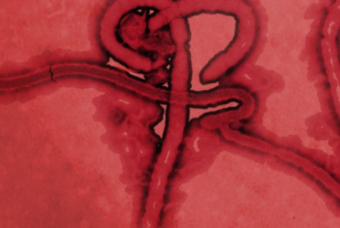 Real-time, portable genome sequencing for Ebola surveillance.